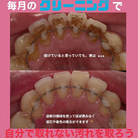 画像312
