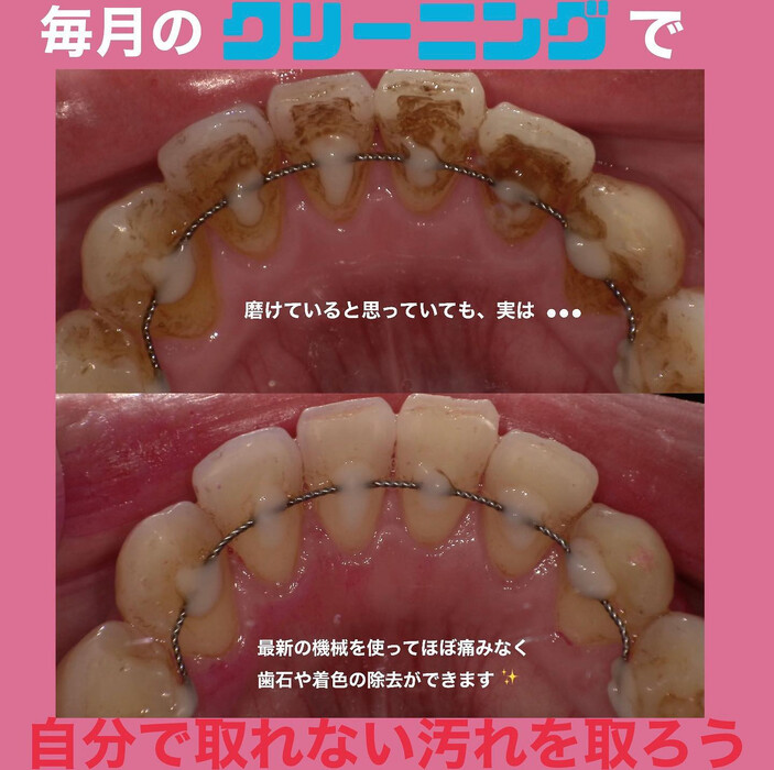 画像312